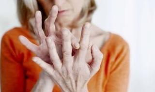 اليوم العالمى للروماتيزم.. اعرف أنواعه وأعراضه عند كبار السن
