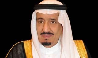 إنفاذًا لتوجيهات خادم الحرمين الشريفين وسمو ولي العهد.. بدء عملية فصل التوأم الملتصق التنزاني "نانسي و نايس"