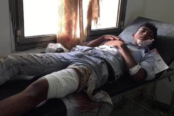 بالصور.. مشاهد حية من جبهة مريس تكشف عن مرتزقة أجانب يقاتلون في صفوف الحوثيين وعن عدد شهداء وجرحى "العود"