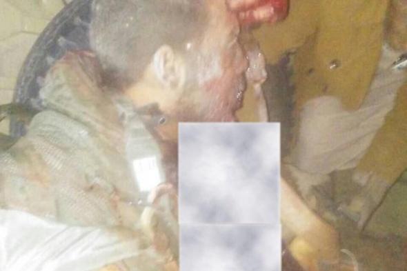 وردنا الان.. شاهد ماذا فعل الحوثيون بقائد طائرة «تورنيدو» السعودي بعد اسقاط طائرته والقبض عليه (صورة صادمة )