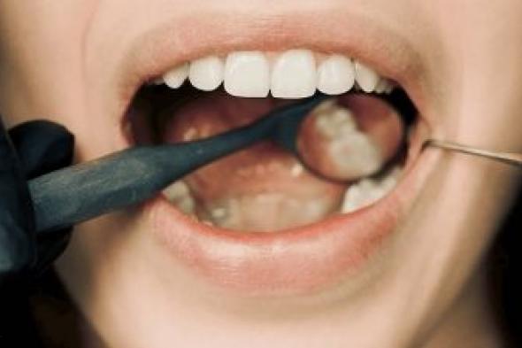 تراند اليوم : الأولى أكثر شيوعاً.. 4 أعراض تشير إلى الإصابة بسرطان الفم