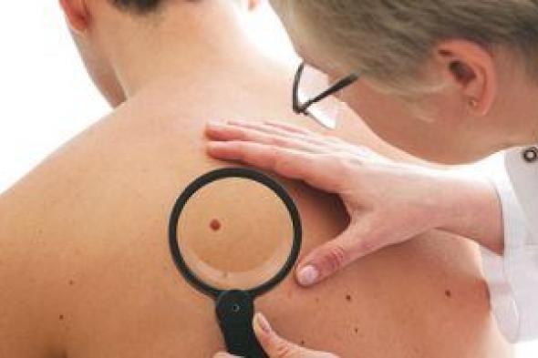 أبرز علامات وأعراض سرطان الدم على الجلد.. اعرفها