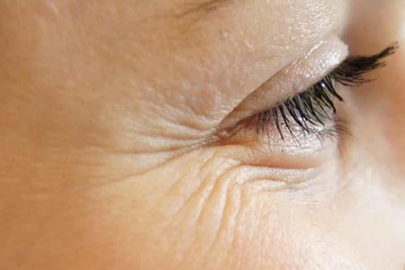 نصائح مهمة للحفاظ على رطوبة منطقة حول العين