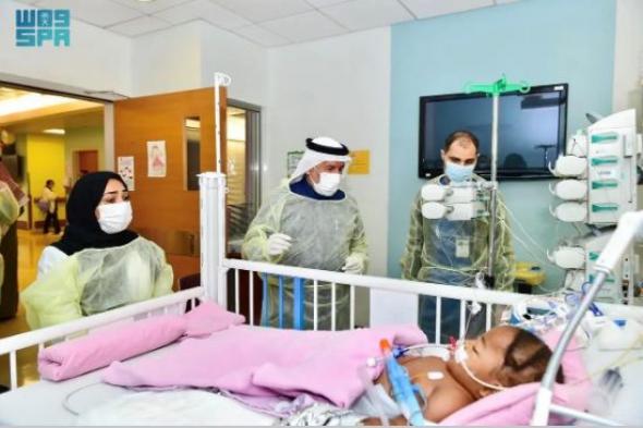 السعودية | استقرار الحالة الصحية للتوأم السيامي النيجيري “حسنة وحسينة” بعد 48 ساعة من فصلهما