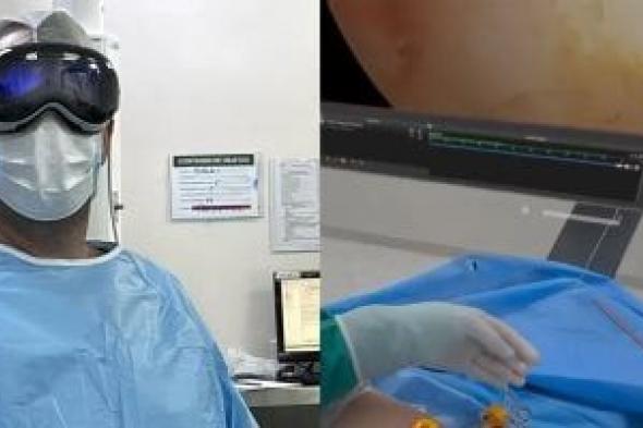 تكنولوجيا: طبيب يستخدام نظارة Apple Vision Pro خلال إجراء جراحة في البرازيل