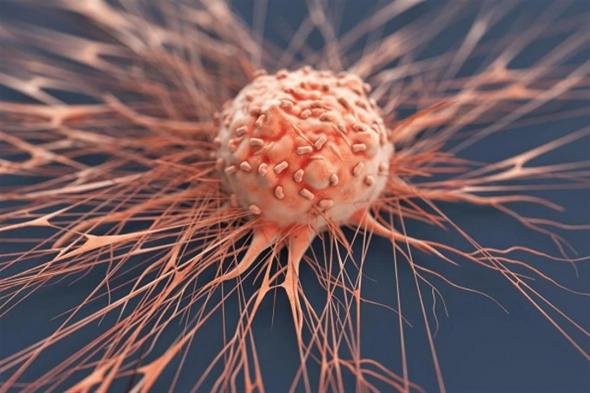 4 أعراض تحذيرية لسرطان قاتل تظهر قبل الإصابة بسنوات