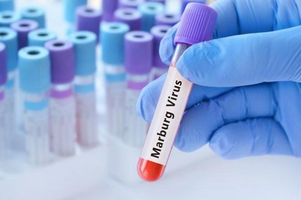 إثيوبيا تعلن انتهاء تفشي وباء ماربورغ